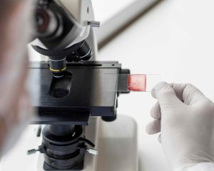 brca-gene-testing-singapore